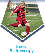 Knee Arthroscopy
