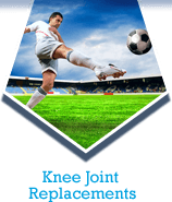 Knee Joint Replacements
