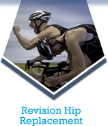 Revision Hip